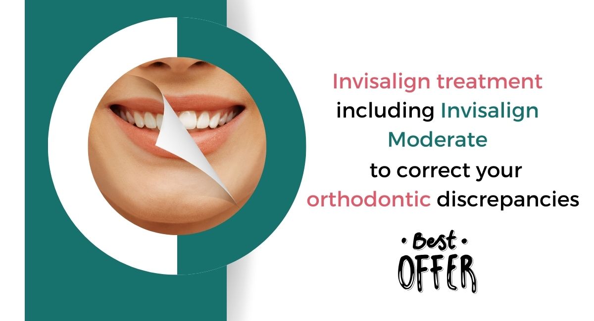 Invisalign treatment including Invisalign Moderate to correct your orthodontic discrepancies